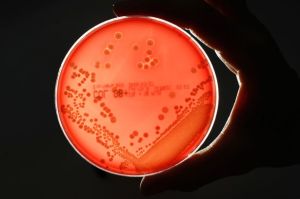 MRSA+superbug